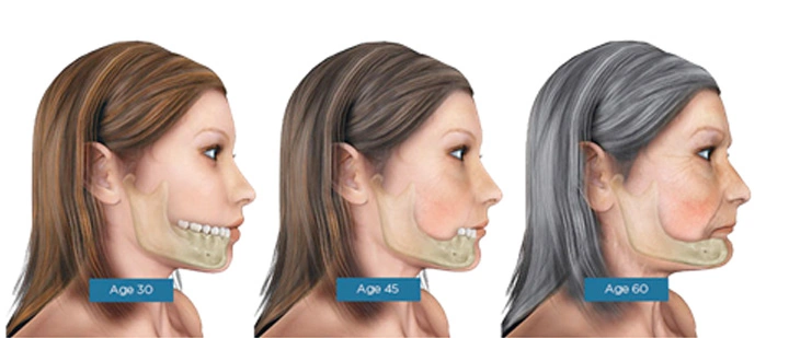 Dentures