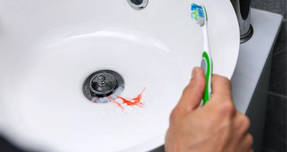 What are the signs of gum disease?