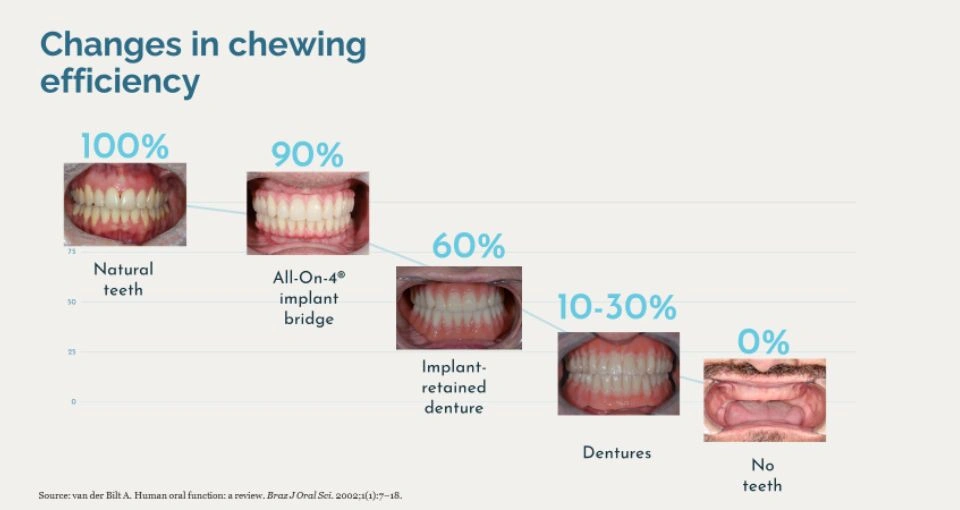 How do prosthetic teeth affect chewing?