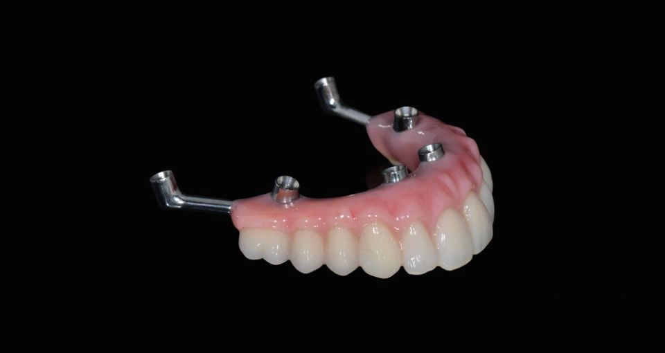 Longer implants