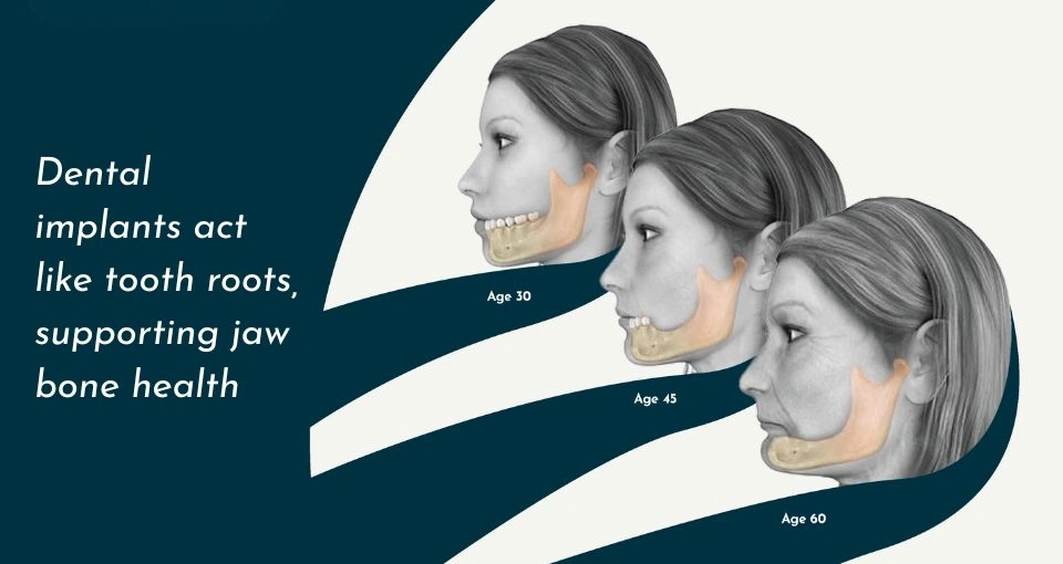 Bone Health Preservation