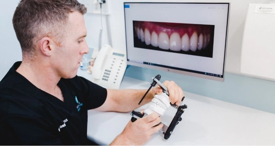 Dental Implants