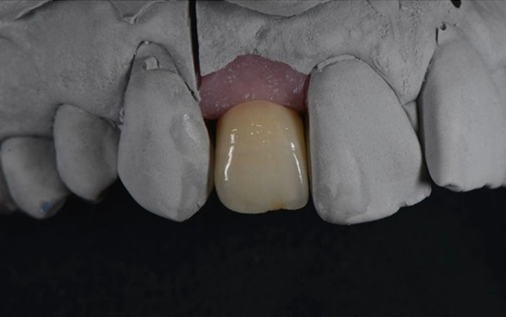 A Strong and Healthy Jawbone