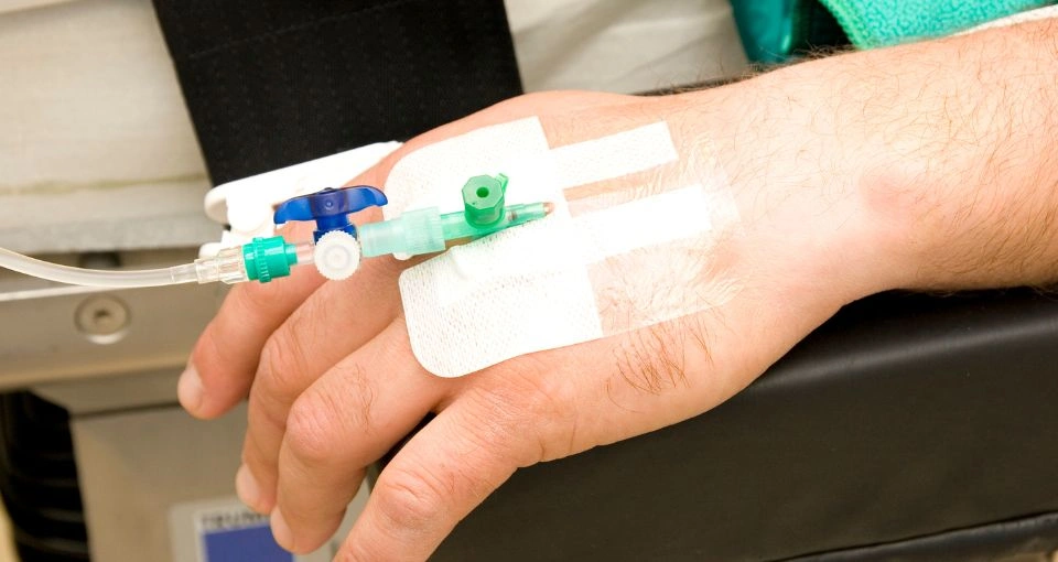 Sleep dentistry (intravenous (IV) sedation)