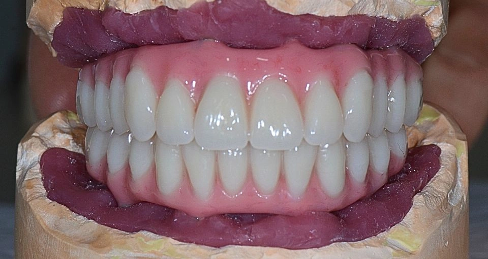 How to choose the right sedation option for me?
