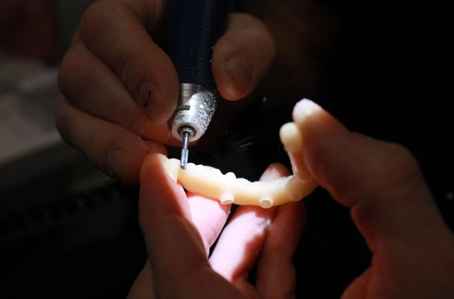 Tooth Materials