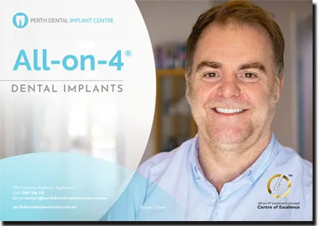 All-on-4® Dental Implants