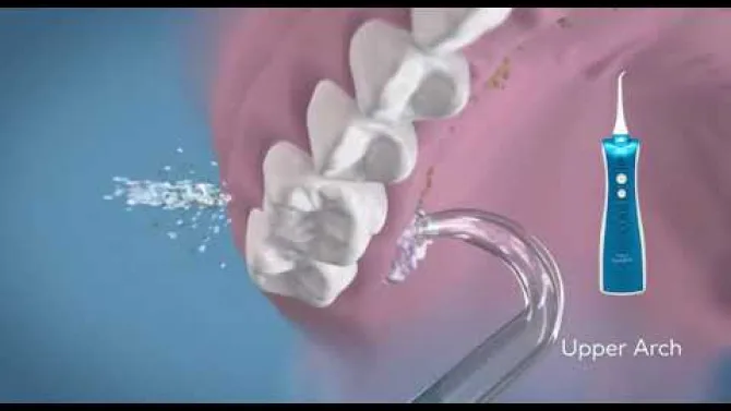 All-on-4® Implants